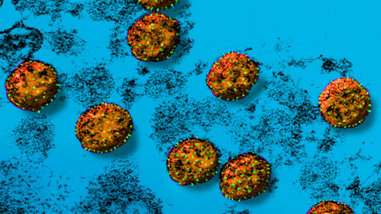 新型コロナウイルスの顕微鏡画像
